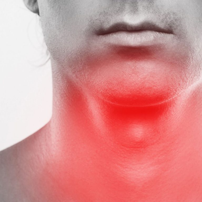 Why Does My Throat Hurt When I Run? [Find Out the Surprising Reason]